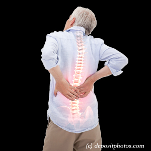 picture Minster back pain with lumbar spinal stenosis